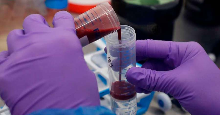 Hospital de La Portada envía ‘plasma hiperinmune’ a Beni y Santa Cruz para enfrentar el coronavirus