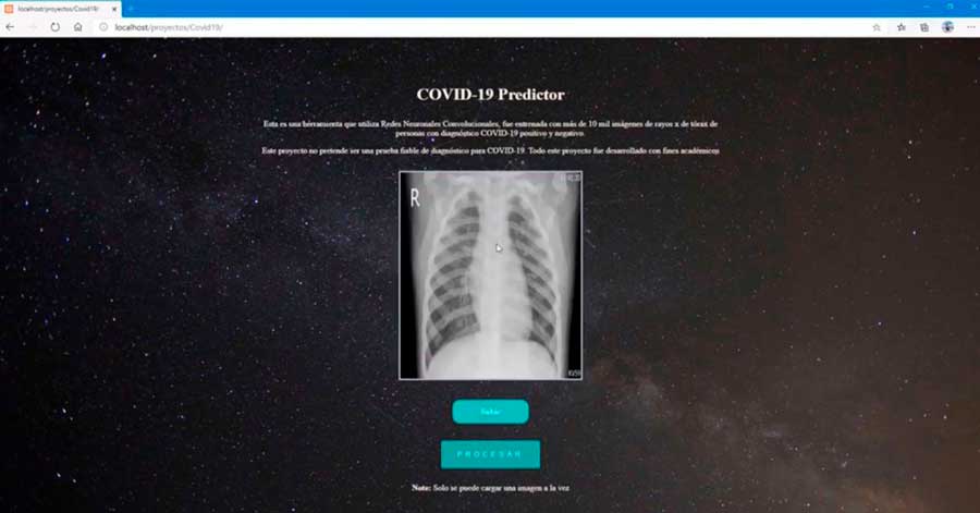 Inteligencia artificial “made in” Tarija permite detectar el Covid