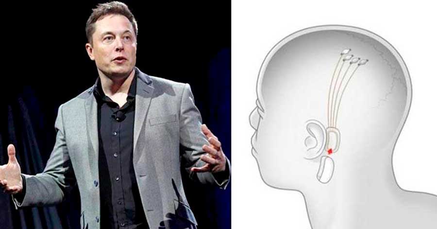 Elon Musk presenta un dispositivo probado en cerdos que mide la actividad cerebral