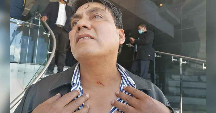 ‘En mi vida me han puesto una uña’: Dan cinco días de impedimento al diputado Héctor Arce por los ‘arañazos’